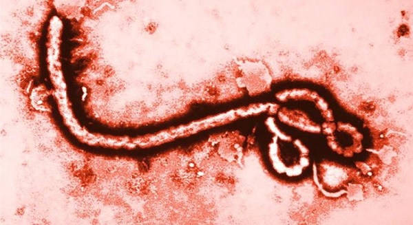 İsveç’te ‘Ebola Virüsü’ne rastlandı