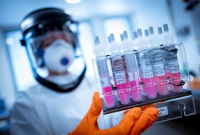 İSVEÇLİ KURUM HAFTADA 100 BİN TEST YAPMAYI PLANLIYOR