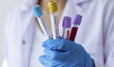 İSVEÇ’TE KORONADAN ÖLENLERİN SAYISI 401 OLDU