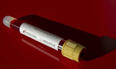 İSVEÇ’TE SON İKİ GÜNDE 94 KİŞİ KORONADAN ÖLDÜ